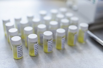 滅菌效果檢測(cè)