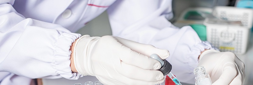 本體法聚氯乙烯樹脂檢測(cè)